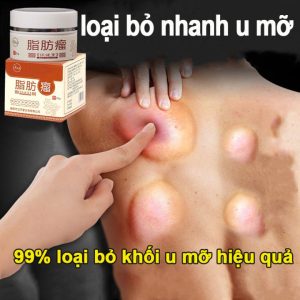 [HCM] kem tan mỡ Kem chuyên dụng cho u mỡ, 99% loại bỏ khối u mỡ hiệu quả & Kem tan u mỡ Tan u cứng U mỡ 30 g Nang dưới da mụn mỡ sơ cứng mọc mụn trên da / loại bỏ nhanh chóng các khối u mỡ  119.000 ₫