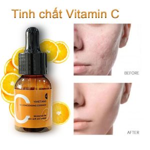 YIHETANG serum trắng da phục hồi da b5 Vitamin C arbutin dưỡng mặt dưỡng da mặt cấp ẩm ₫79.000 - ₫137.000
