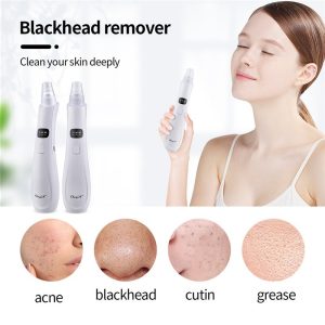 CkeyiN Máy hút mụn đầu đen làm sạch lỗ chân lông kèm 5 đầu hút chuyên dụng máy hút mụn cầm tay MR596 116.000₫